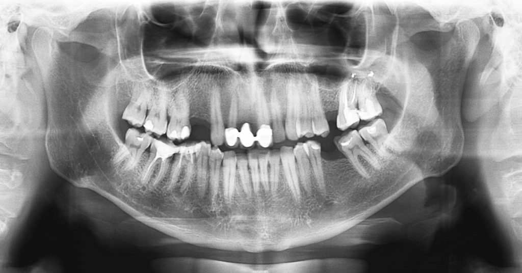 The Man Who Drank Radioactive Juice Until His Bones Crumbled And His Jaw Came Off - Featured image