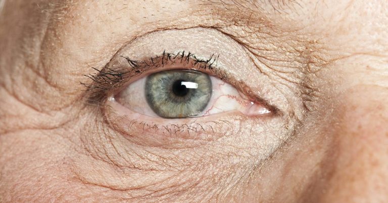 Our eyes may provide early warning signs of Alzheimer’s and Parkinson’s - Featured image