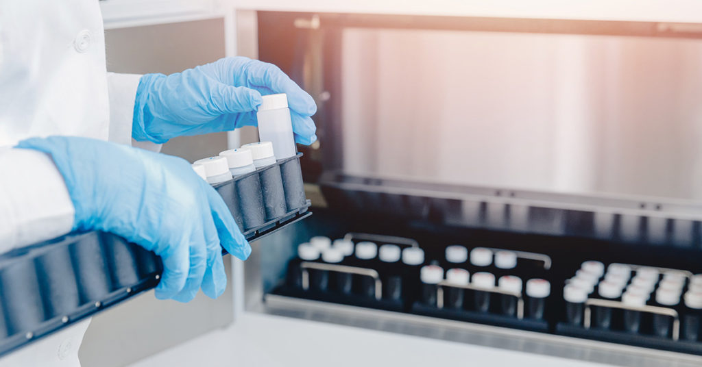 Medical Company Introduce Hands-Free Automatic ‘Sperm Extractor’ For Donors - Featured image