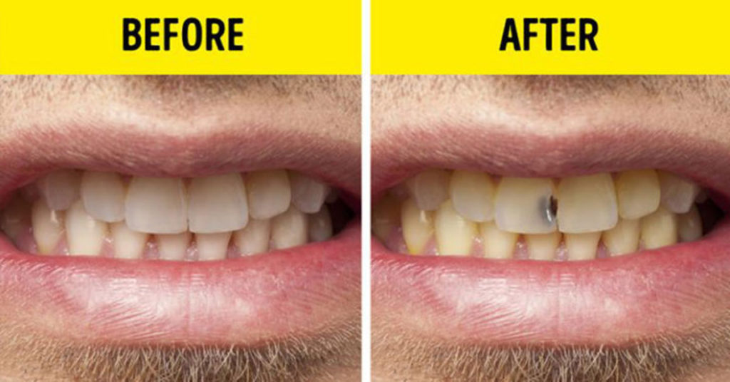 7 Everyday Habits It’s Better Get Rid of As Soon As Possible - Featured image