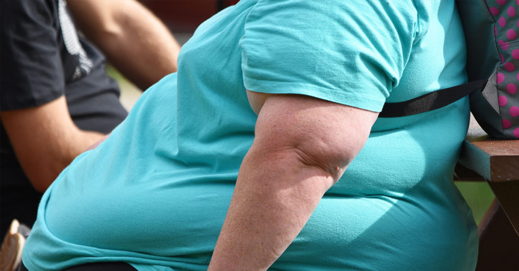 Weight Loss Device That Locks Jaw Shut To ‘Tackle Obesity’ Sparks Outrage - Featured image