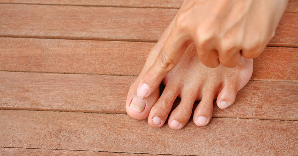 Dermatologists Explain the Cause of Nail Fungus (and How to Fix It) - Featured image