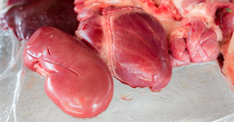 Genetically Engineered Pig Kidney Successfully Transplanted to Human Patient In World First - Featured image