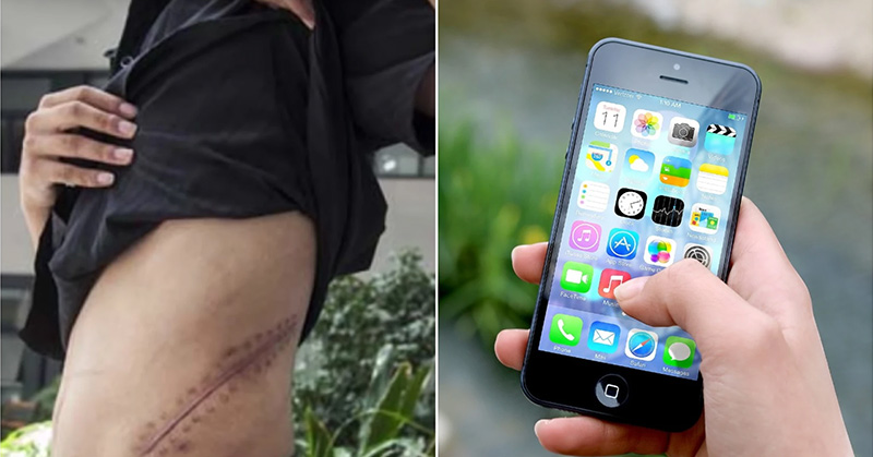 Teen Who Sold a Kidney for an iPhone Is Now Bedridden for Life