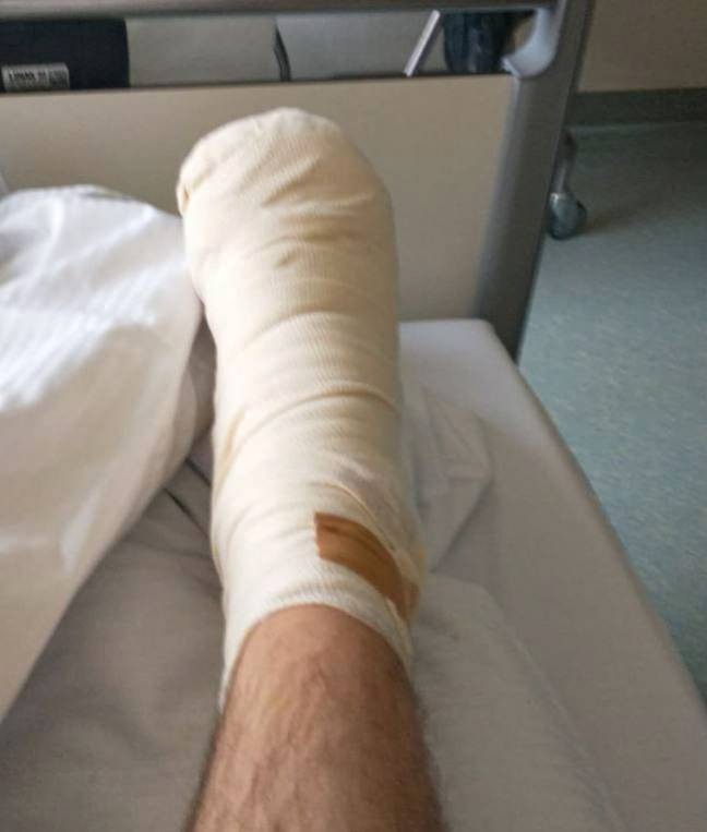 Steve's bandaged leg after the bite