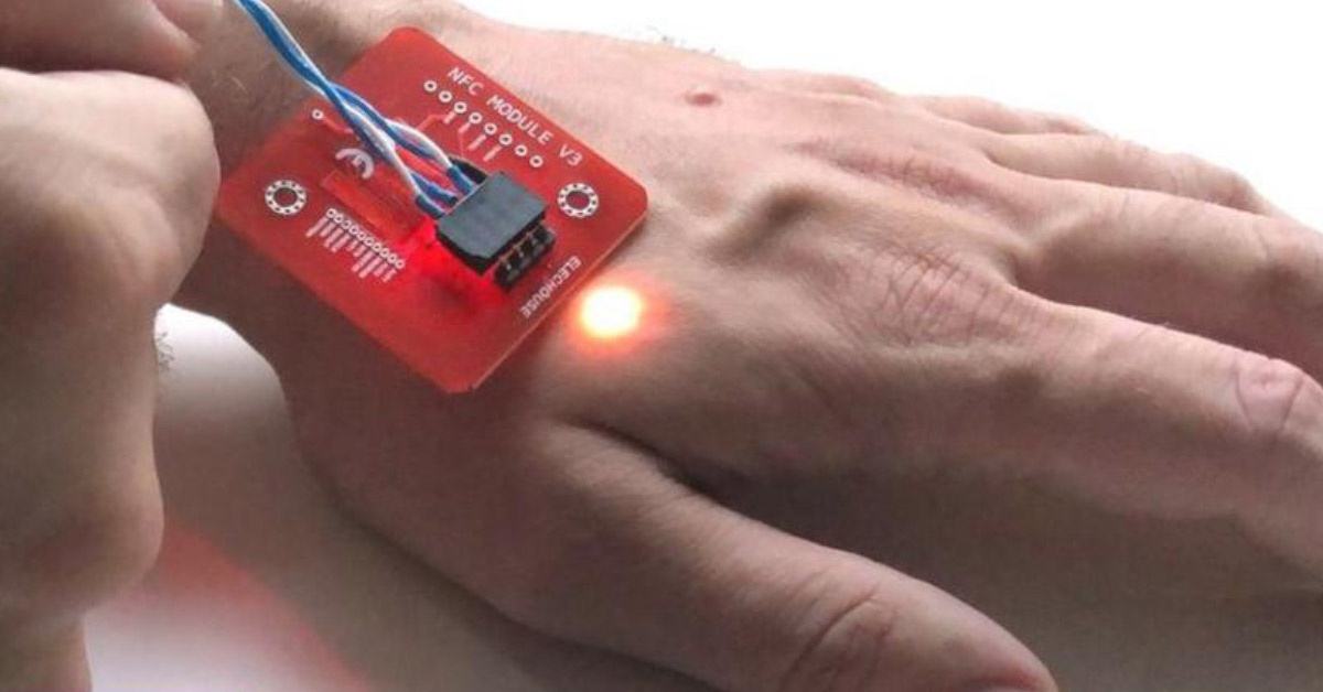 The microchip implants that let you pay with your hand The Premier Daily