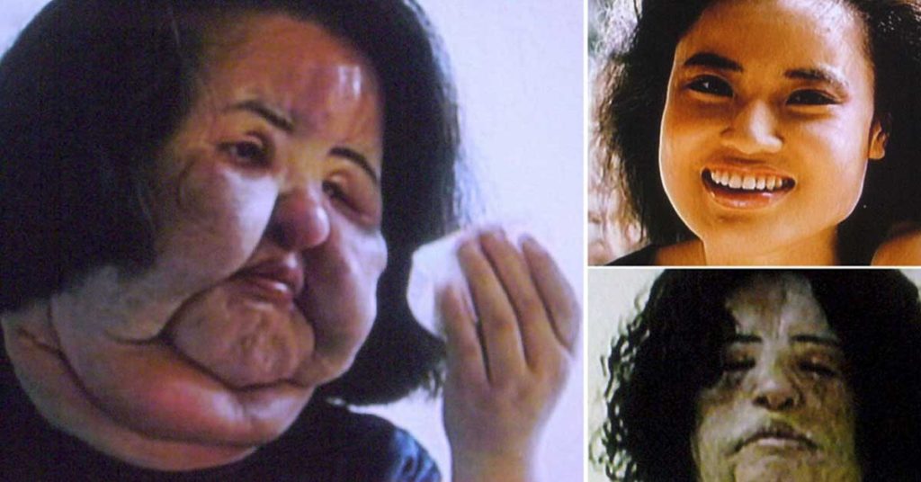 Woman who injected COOKING OIL into her own face after doctors refused...