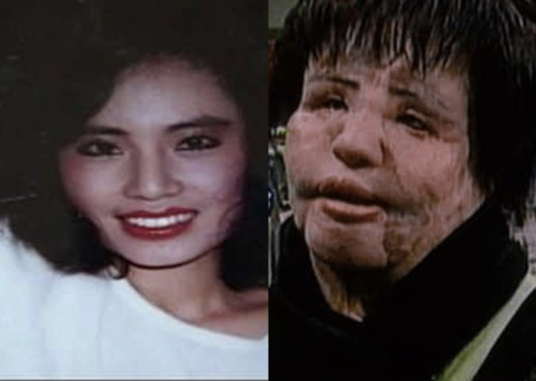 Hang Mioku Where is She Now? Plastic Surgery Obsession Almost Took Her