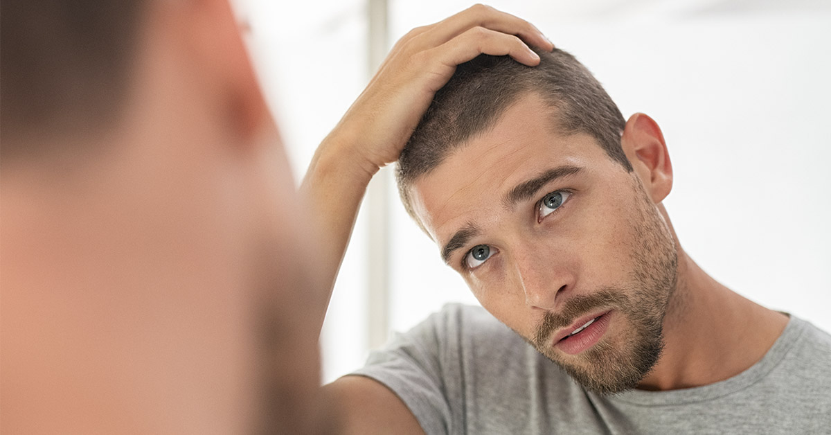 man examining his scalp for hair loss
