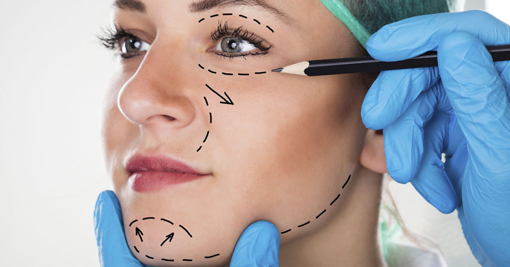 Woman with ‘world’s biggest cheeks’ is unrecognizable in pic taken six years ago - Featured image