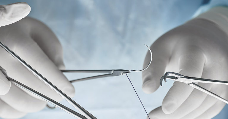 Scientists Grow ‘Yarn’ From Human Flesh So They Can Stitch People Up, Repair Organs - Featured image