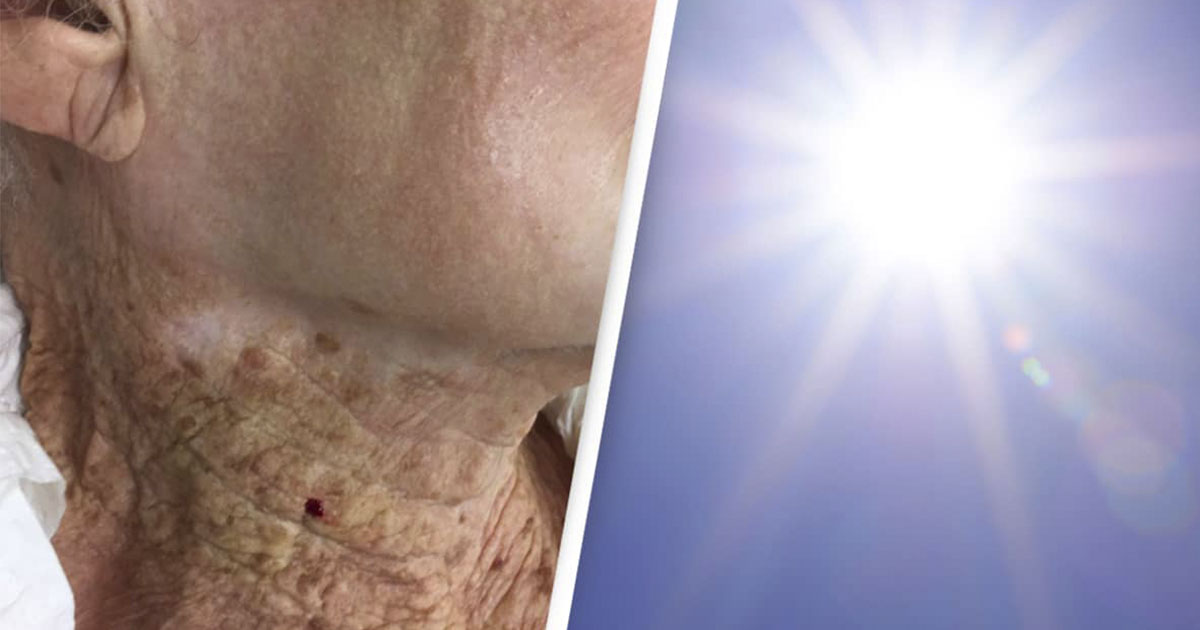 Striking picture shows consequences of 92yearold woman using