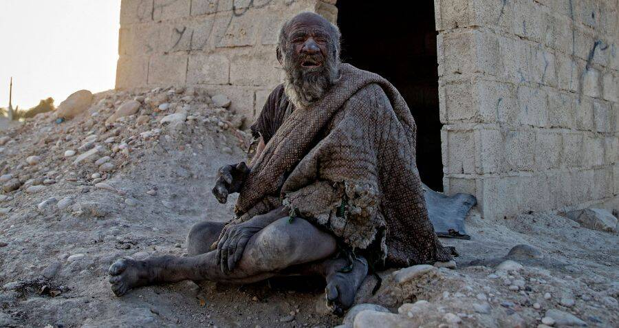 Amou Haji - The world's dirtiest man.