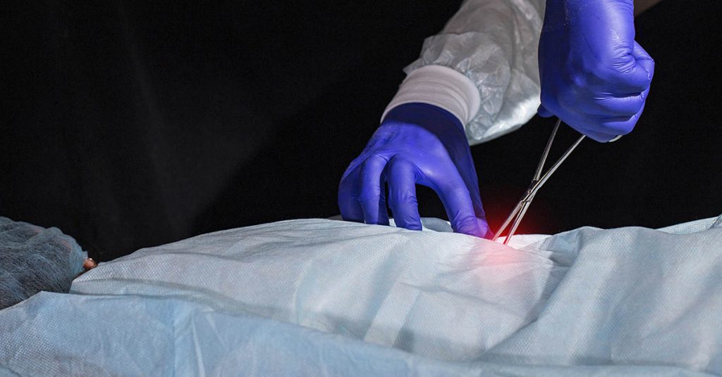 Paralyzed Man Can Walk Again With Brain and Spine Implants - Featured image