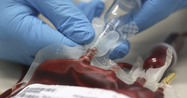 Bryan Johnson, 45, spends $2M and uses teen son’s blood attempting to reduce biological age - Featured image