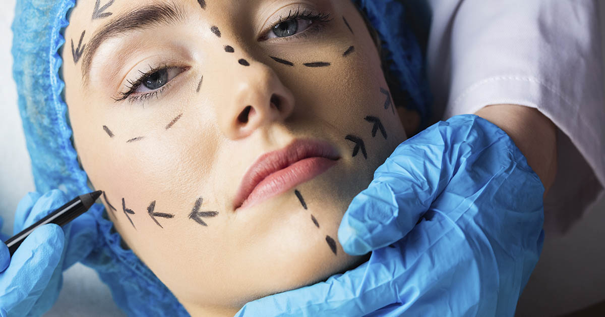woman with markings on her face pre surgery