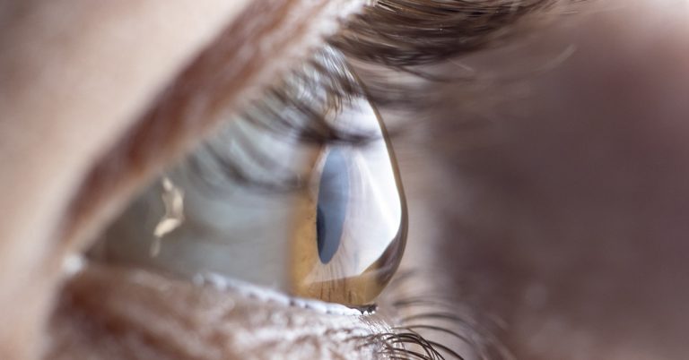 If you see these beams on lights you have a specific condition not everyone has - Featured image