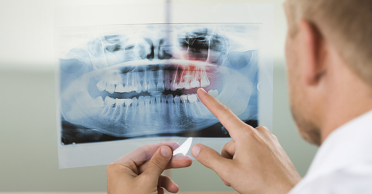 dentist pointing at x-ray of mouth