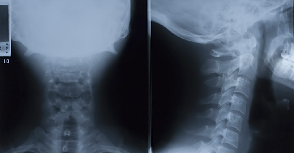 Doctor Gives Warning Over Holding in a Sneeze After Man Damages Throat - Featured image