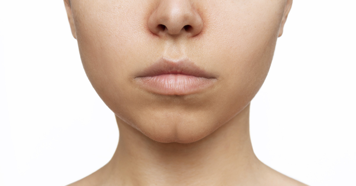 woman with chin dimple