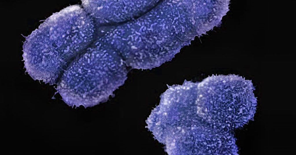 Humans Could Become Extinct Unless Men Develop a New Sex Gene - Featured image